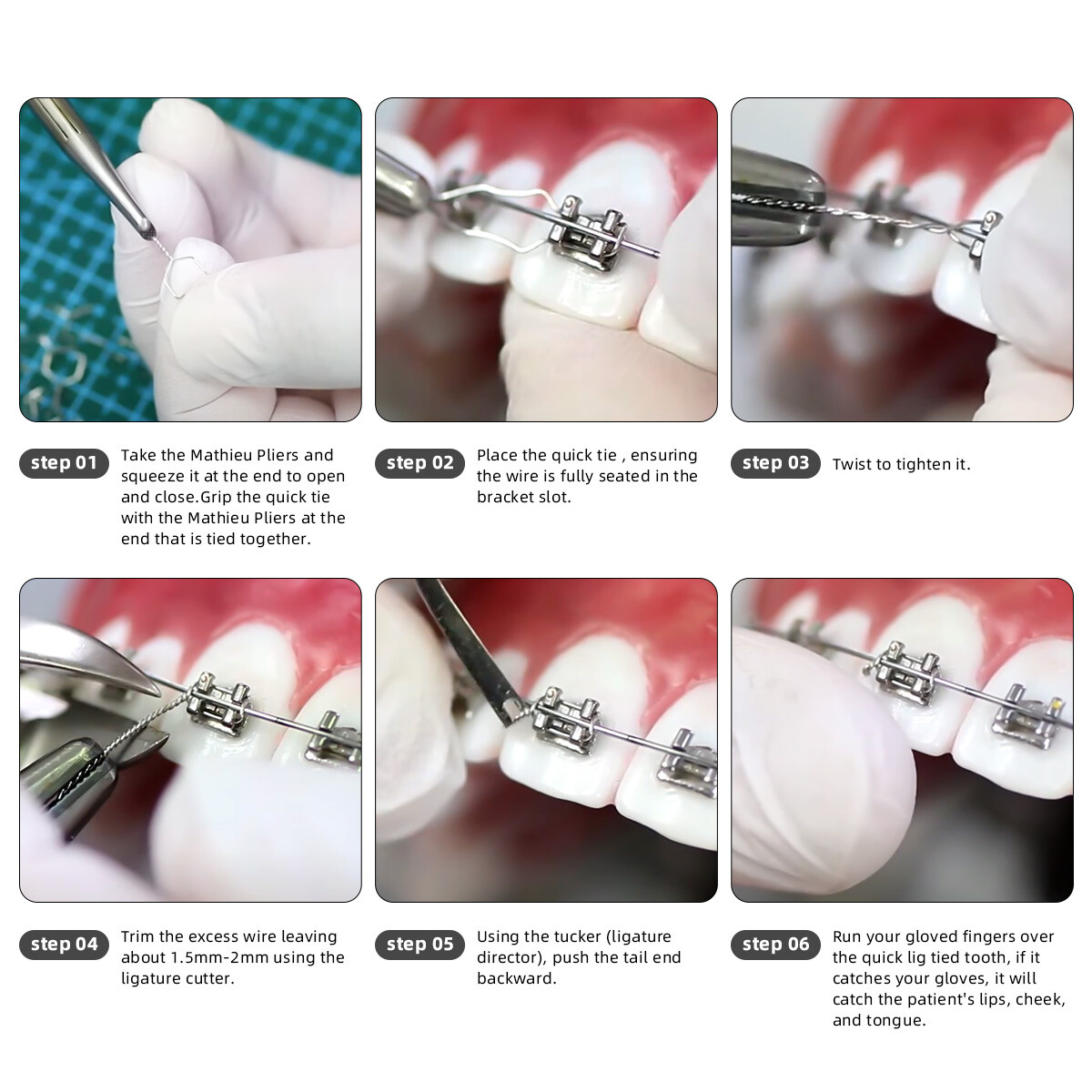 Alambre de Ortodoncia Dental Preformado Ligadura Ataduras Acero Larga Corta Tors