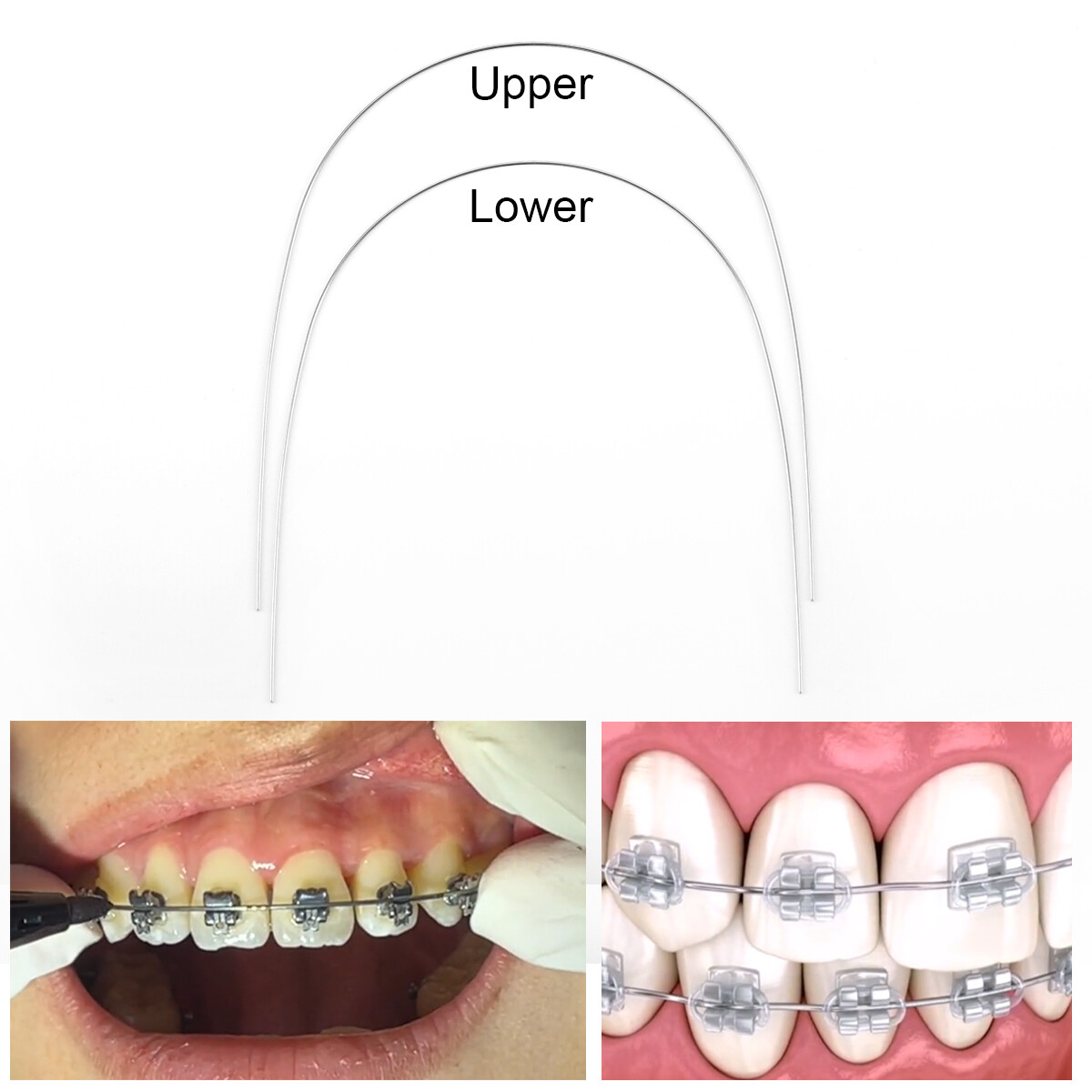 AZDENT Dental Orthodontic Super Elastic Niti Round Arch Wires Nature Form FDA