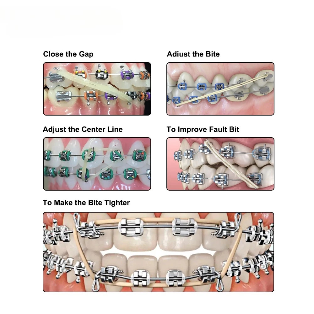 3.5-6.5OZ Dental Ortho Elastics Latex Braces Orthodontic Rubber Band 5000Pcs/Box